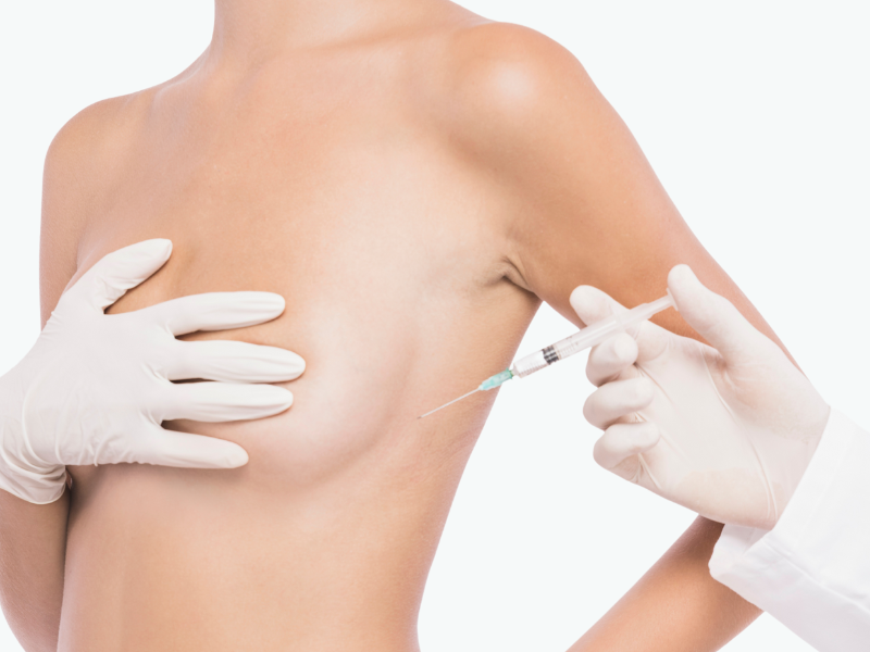 Is Areola Reduction Included with my Breast Uplift Package 1 Areola Reduction