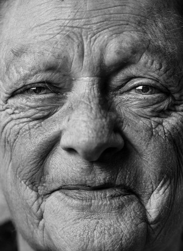 Wrinkles