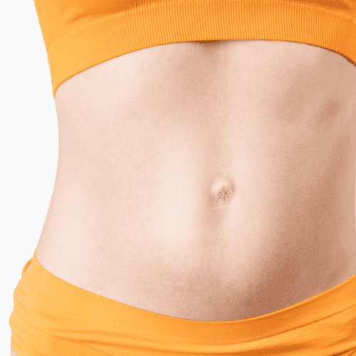 A Mini Tummy Tuck Transform Your Midsection (2)