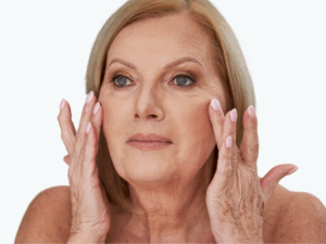 Chin Augmentation 23 wrinkles on face