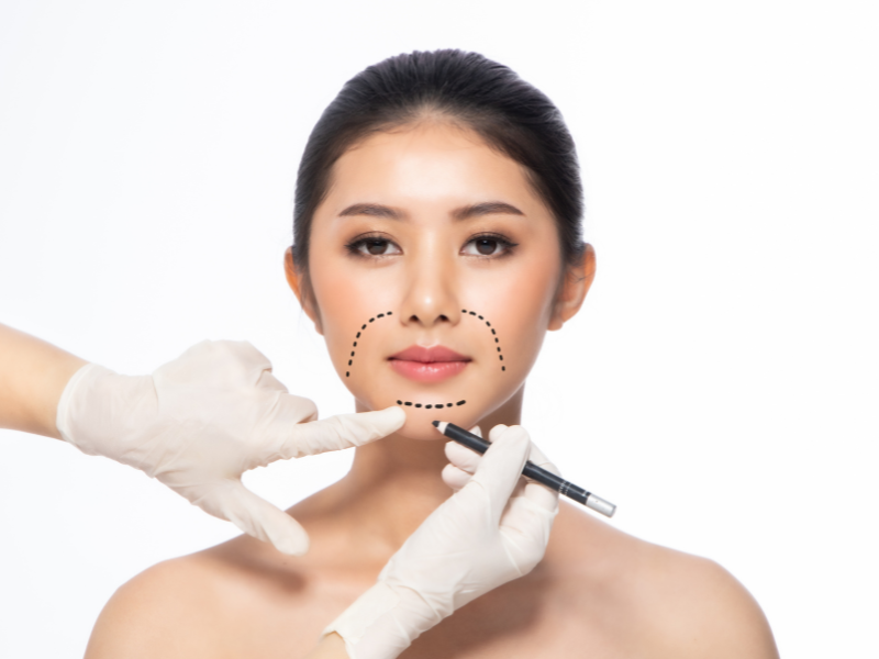 What is Face Contouring? 1 Dr Faisal blog 800x600 5 1