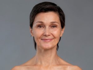 Facelift for saggy face in Dubai