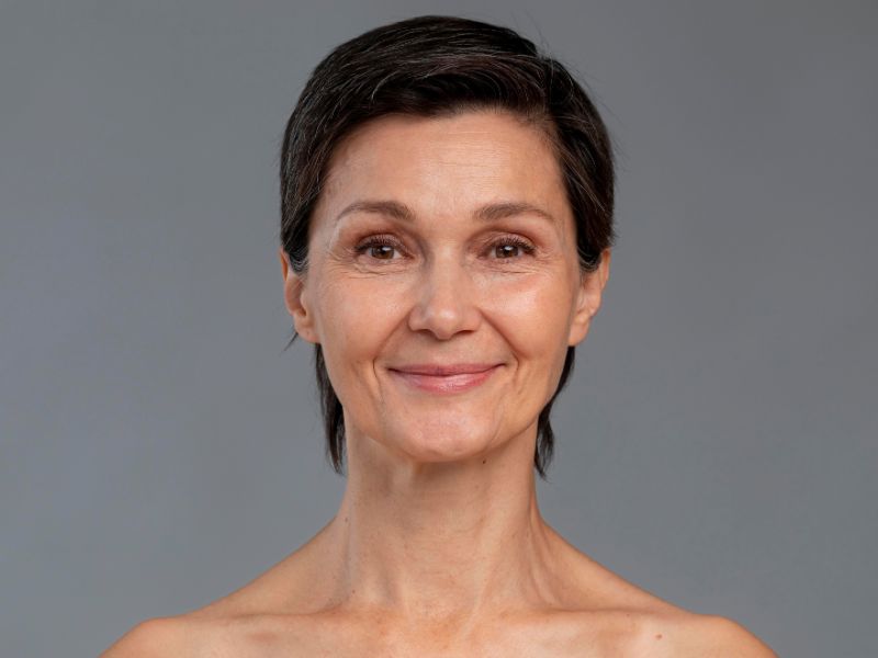 Facelift for saggy face in Dubai