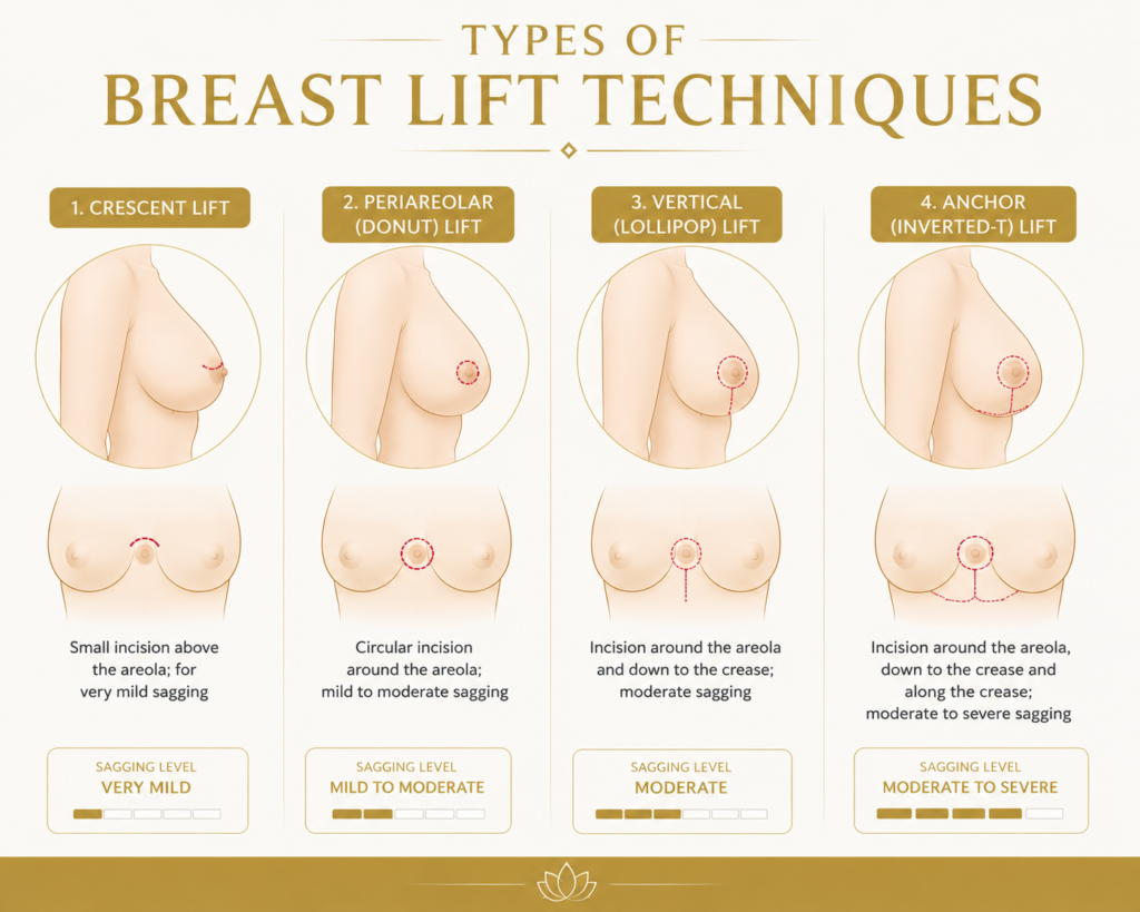 Different Types of Breast Lift Techniques by Dr Faisal